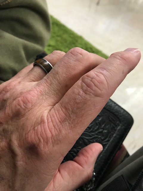 28459295_1861437380536063_1738681327_n